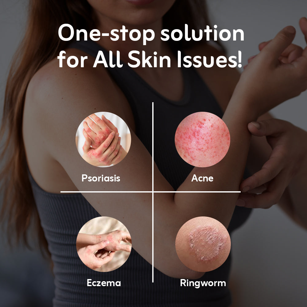 Ayurvedic itching oil