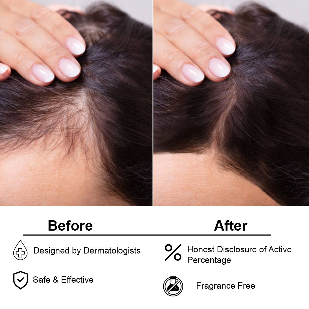 Herbal Hair Serum