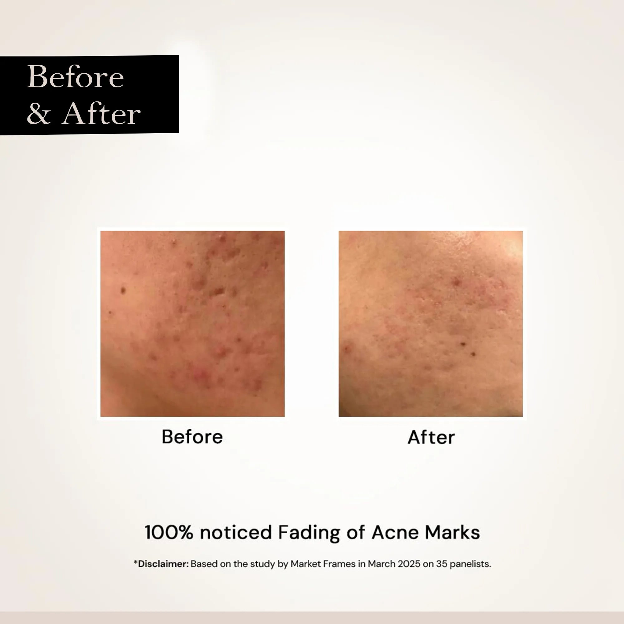 Face Glow Night Serum – Dark Spot & Brightening Face Serum (10 ML)