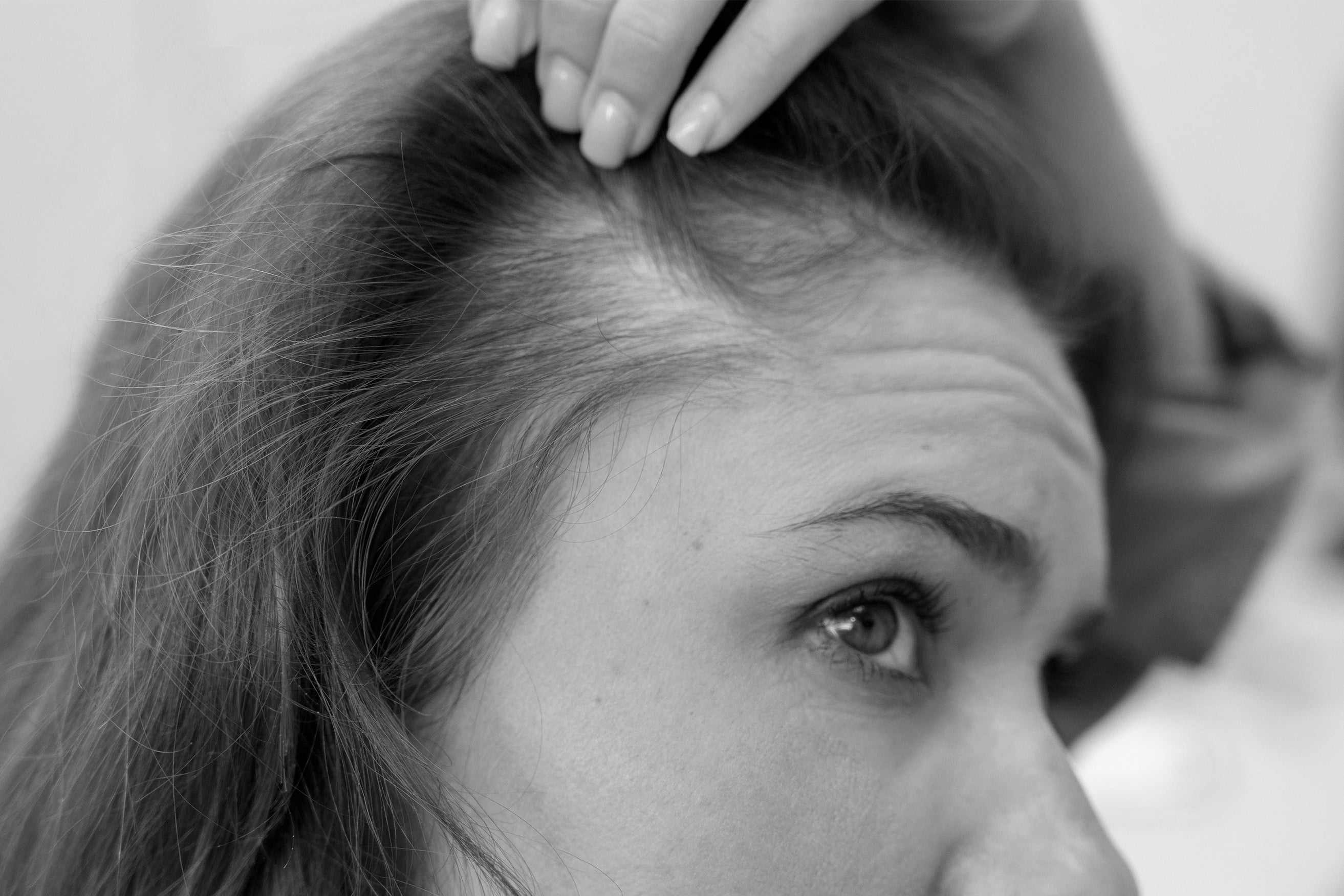 Hair Fall